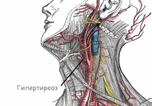 Иллюстрация к записи «Какими симптомами проявляются заболевания щитовидной железы»