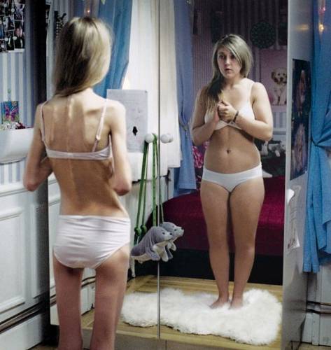 Девушка больная анорексией смотрит в зеркало