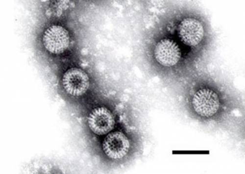 Фотография ротавируса