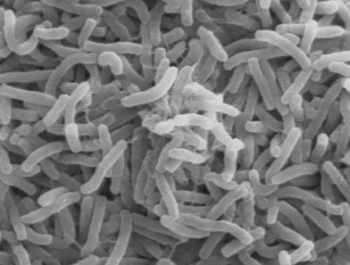 Бактерии холеры: вид под микроскопом