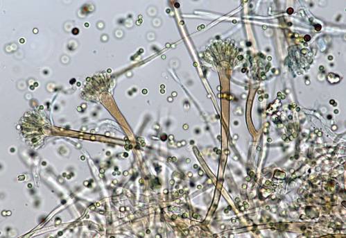 Грибок Aspergillus fumigatus под микроскопом