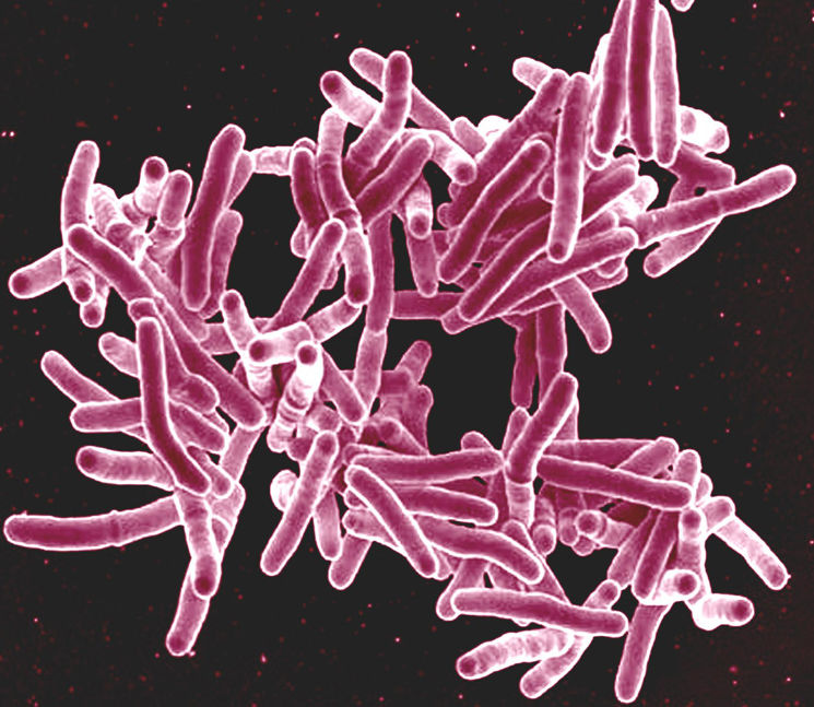 Как проявляется туберкулез – симптомы и лечение заражения палочкой Коха