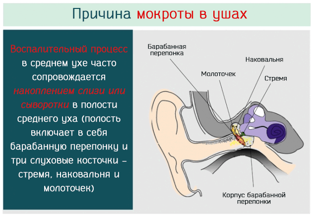 Как избавиться от странных выделений в ушных проходах – катар уха