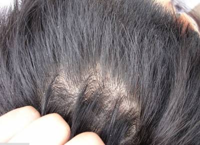 Иллюстрация к записи «Наиболее частые заболевания кожи головы и эффективное лечение»