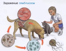 Иллюстрация к записи «Как проявляется лямблиоз – заражение паразитами и способы лечения»