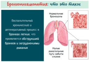 Иллюстрация к записи «Какие болезни могут стать причиной затруднения дыхания»
