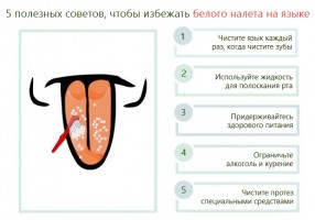 Иллюстрация к записи «Какие болезни вызывают изменение цвета языка – скажите «А»»