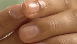 Иллюстрация к записи «Сухие корки вокруг ногтей – как от них избавиться»