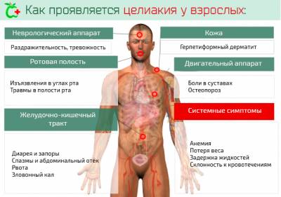 Иллюстрация к записи «По каким симптомам можно подтвердить целиакию кишечника у человека»