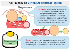Иллюстрация к записи «Поможет ли антицеллюлитный крем в лечении изменений кожи при целлюлите»