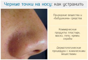 Иллюстрация к записи «Черные точки на носу – как их устранить: пластыри, медицинские и»