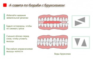 Иллюстрация к записи «7 правил, которые избавят от скрежетания зубами»