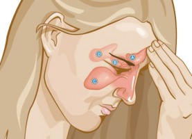 Иллюстрация к записи «Какие могут быть причины боли головы во лбу и над глазами»