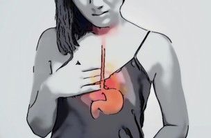 Иллюстрация к записи «Каковы причины жжения в желудке – это не всегда рефлюкс»
