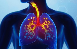 Иллюстрация к записи «8 симптомов при кашле, связанных с пневмонией легких»