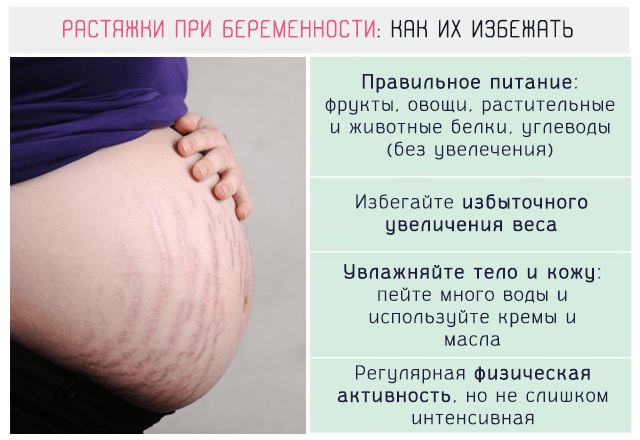 Что поможет избежать растяжек при беременности