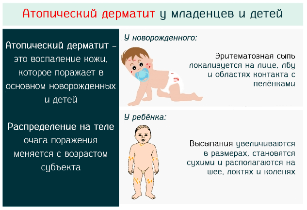 Проявления атопического дерматита у младенцев и детей