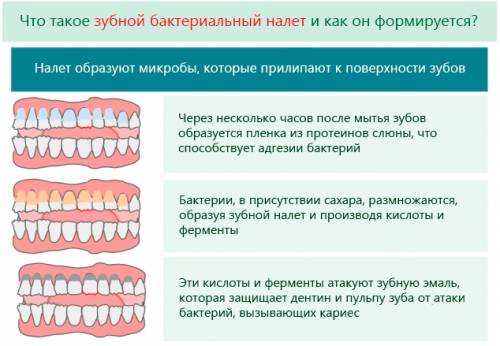 Что такое зубной бактериальный налет
