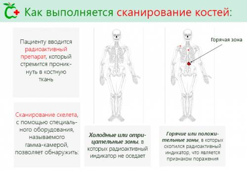 Как выполняется сканирование костей