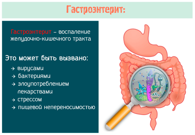 Гастроэнтерит – воспаление желудочно-кишечного тракта