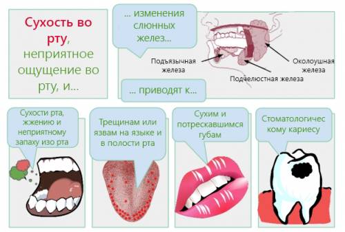 К чему приводит сухость рта (ксеростомия)