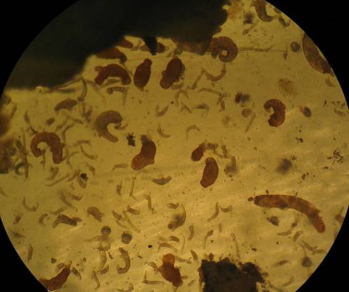 Трематоды внутри улитки