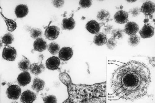 Микрофотография вируса HHV-6