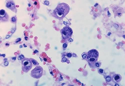 Макрофотография цитомегаловируса