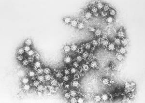 Чем опасен вирус Коксаки: как происходит заражение и возможное лечение