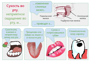 Лечение сухости рта – причины ксеростомии ротовой полости