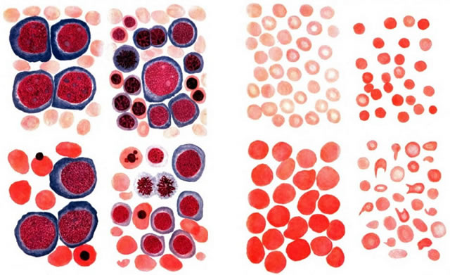 Морфология периферической крови и другие исследования состава