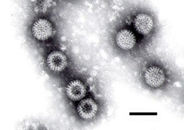 Анализ кала детей на ротавирус – в поиске причин диареи
