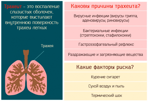 Симптомы трахеита дыхательный путей – какое лечение поможет