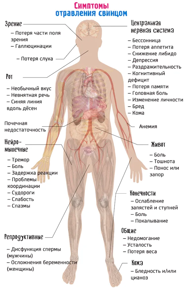 Полный список симптомов отравления свинцом