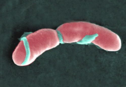 Кишечная палочка Listeria monocytogenes под микроскопом