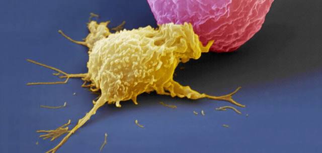 Природные клетки-киллеры определяют раковые клетки или инфицированные вирусом клетки