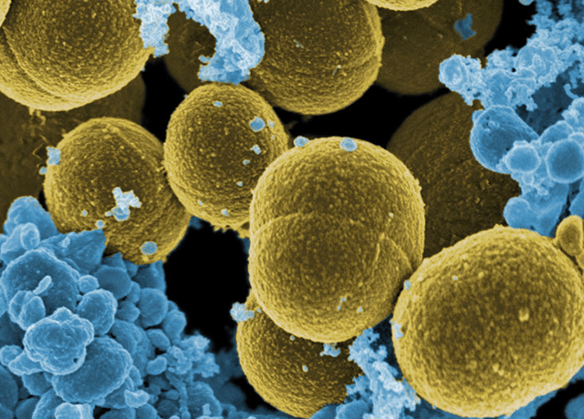 Активные бактерии золотистого стафилококка под микроскопом