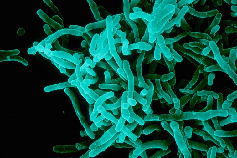 Колония бактерий вызывающих дифтерию