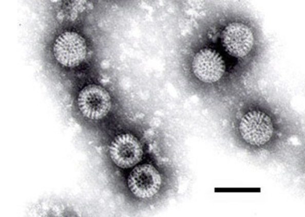 Макрофотография ротавируса