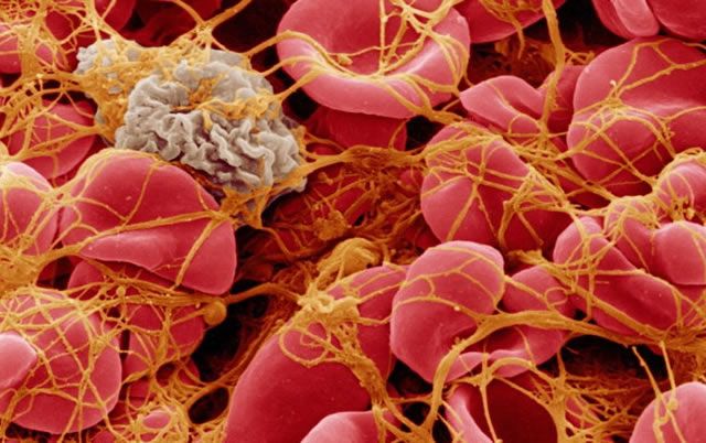 Клетки-тромбоциты формируют тромб из клеток крови