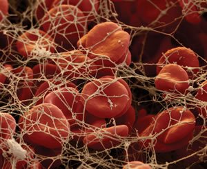 Процесс образования сгустка крови на основе фибриногена
