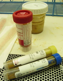 Колбы с калом для анализа на содержание крови
